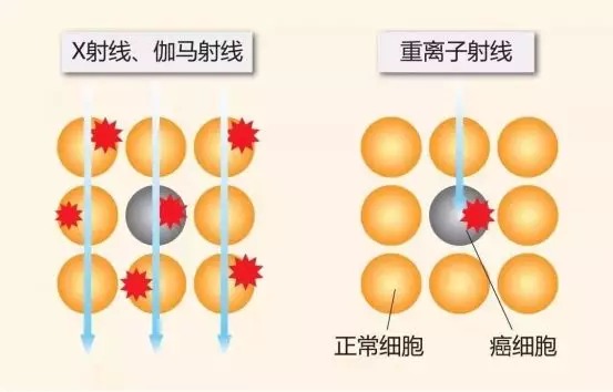 质子重离子技术医疗险可以报销吗？